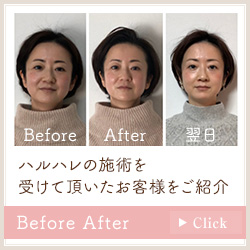 BeforeAfter