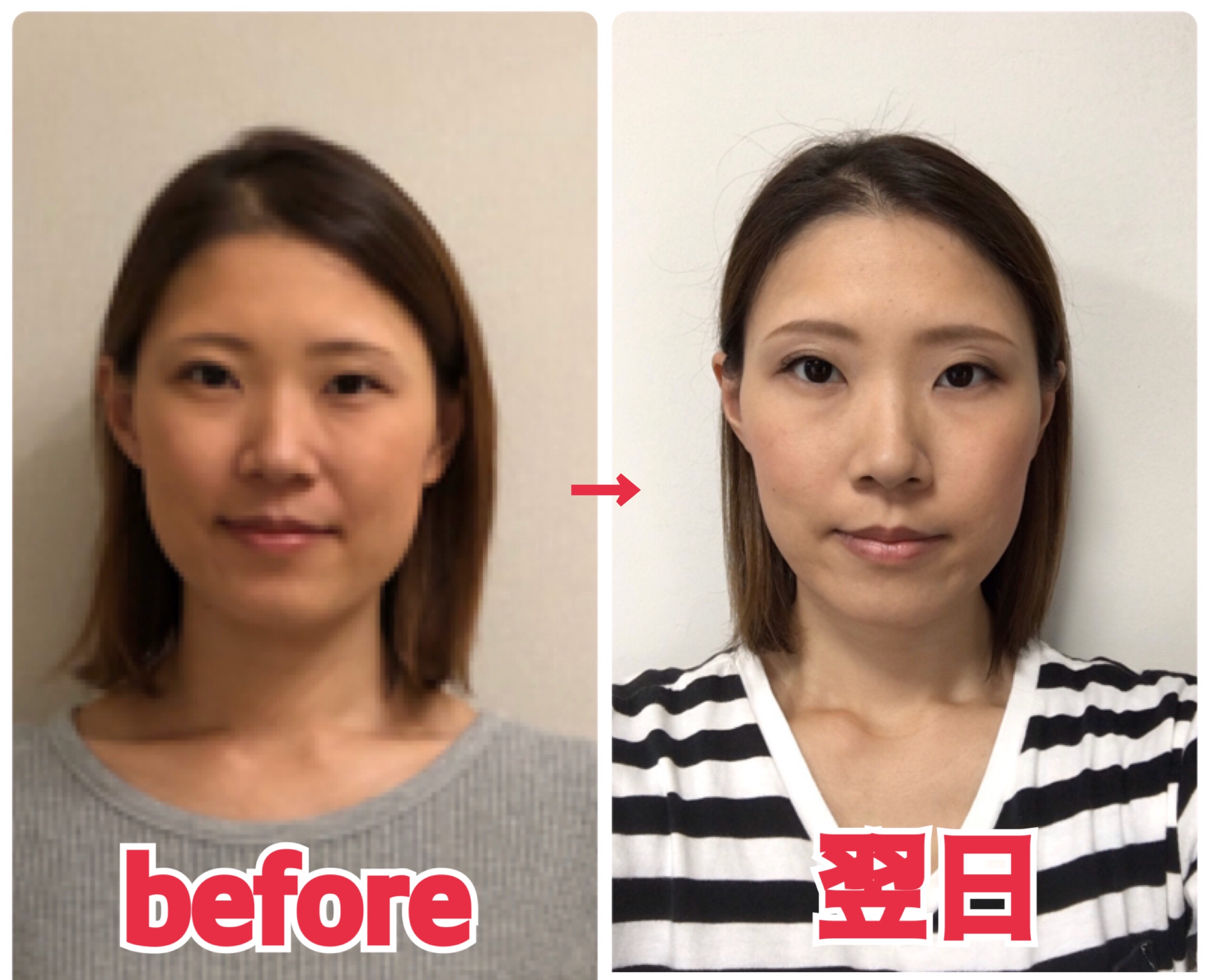 年代別ビフォーアフター ３０代のお客さま編